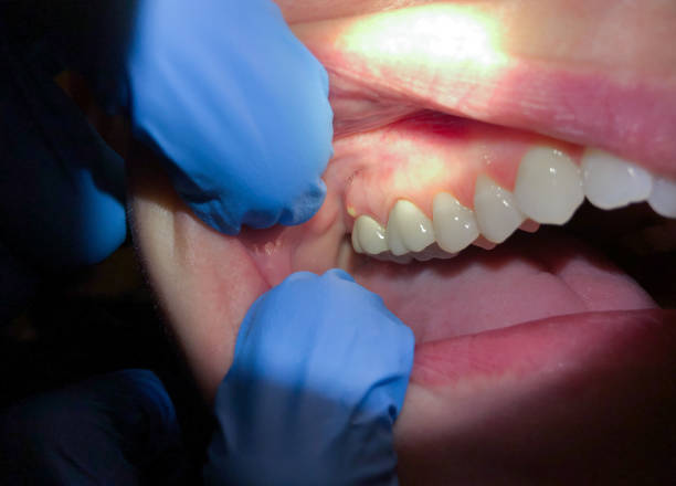 Best Emergency Dental Surgery in High Point, NC
