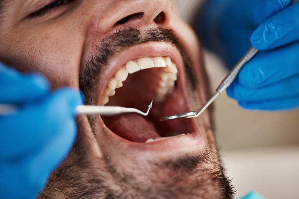 Best Emergency Treatment for Toothache in High Point, NC